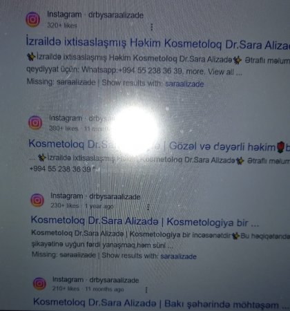 Sara Əlizadə lisenziyasız kosmetoloji fəaliyyətlə məşğuldur? -Sosial hesablarını bağladı….-FOTOFAKT