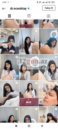 “Laser Beauty Clinic”in bağlanan filialından YENİ BİABIRÇI GÖRÜNTÜLƏR: Türkiyəli həkim görün nə paylaşıb / FOTO